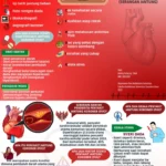 Alarm Kesehatan: Kasus Penyakit Jantung Meroket, Prof. Antonia Lukito Ungkap Peran Kalsifikasi Koroner di UPH
