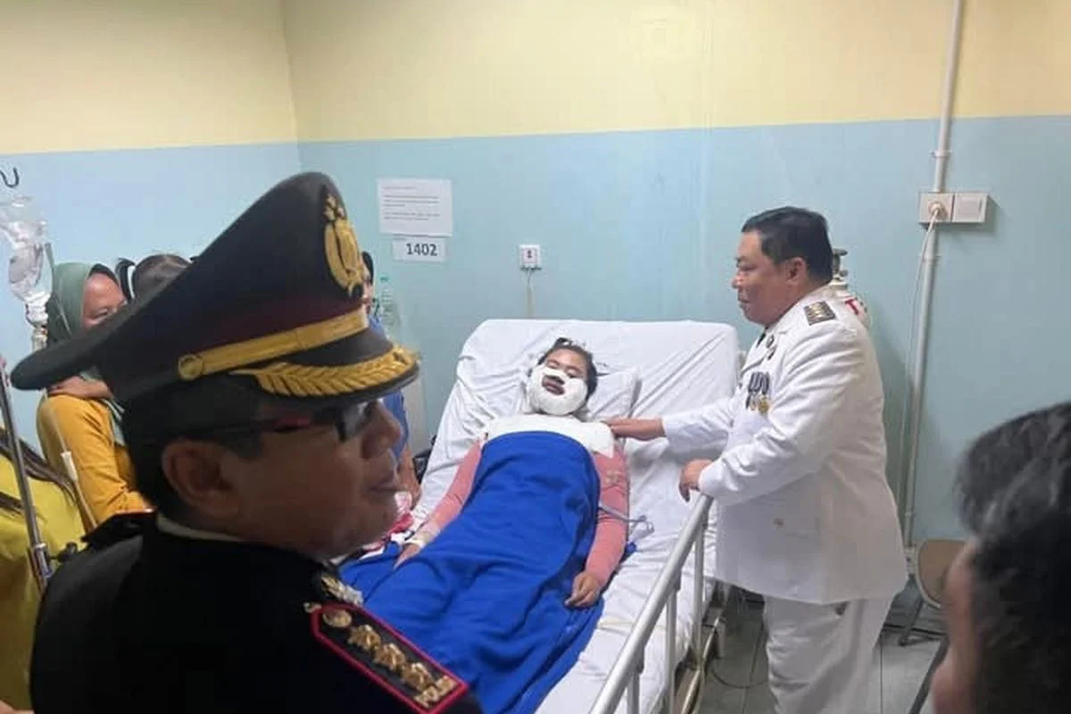 Terungkap! Aktivis Kontras Disiram Air Keras, Profesor Kadri Klaim Tindakan Individu Tanpa Motif Politik